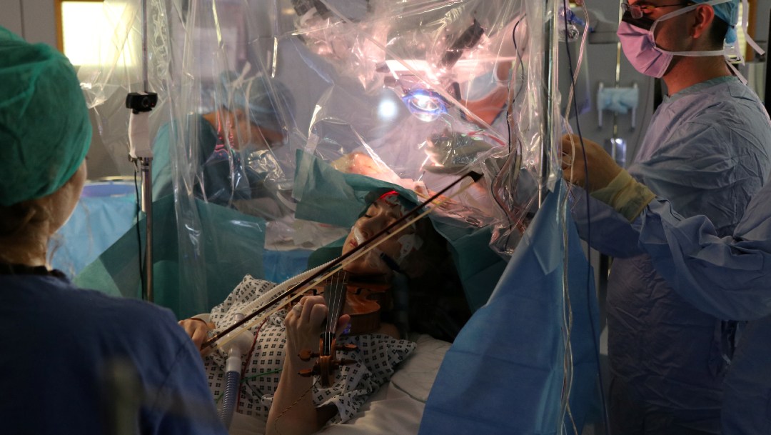 Mujer toca el violin mientras le operan el cerebro