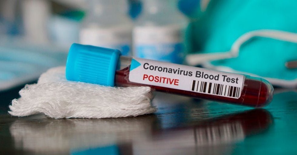 Si tu tipo de sangre es A positivo corres más riesgo de contraer coronavirus