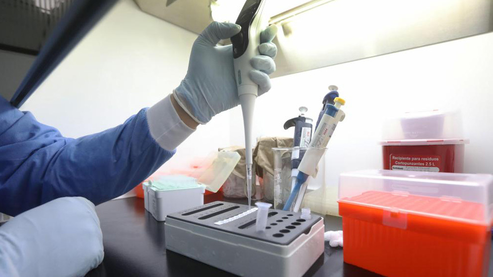 Coronavirus presente en semen, nuevo hallazgo de investigadores chinos.