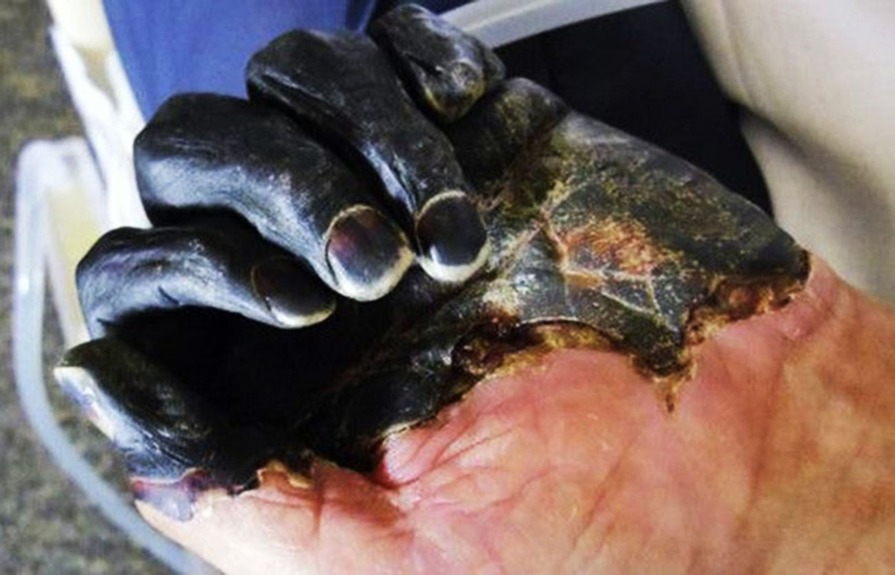 Mongolia cierra frontera con Rusia por dos casos de peste negra