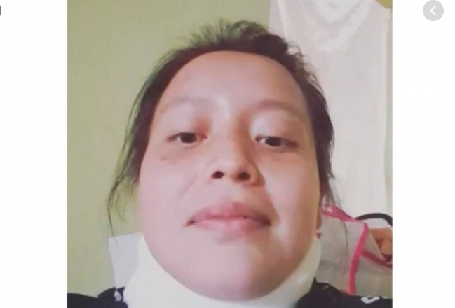  Monserrat González, originaria del municipio de Calimaya, narró las amenazas y ataques a muerte por parte de su ex pareja.