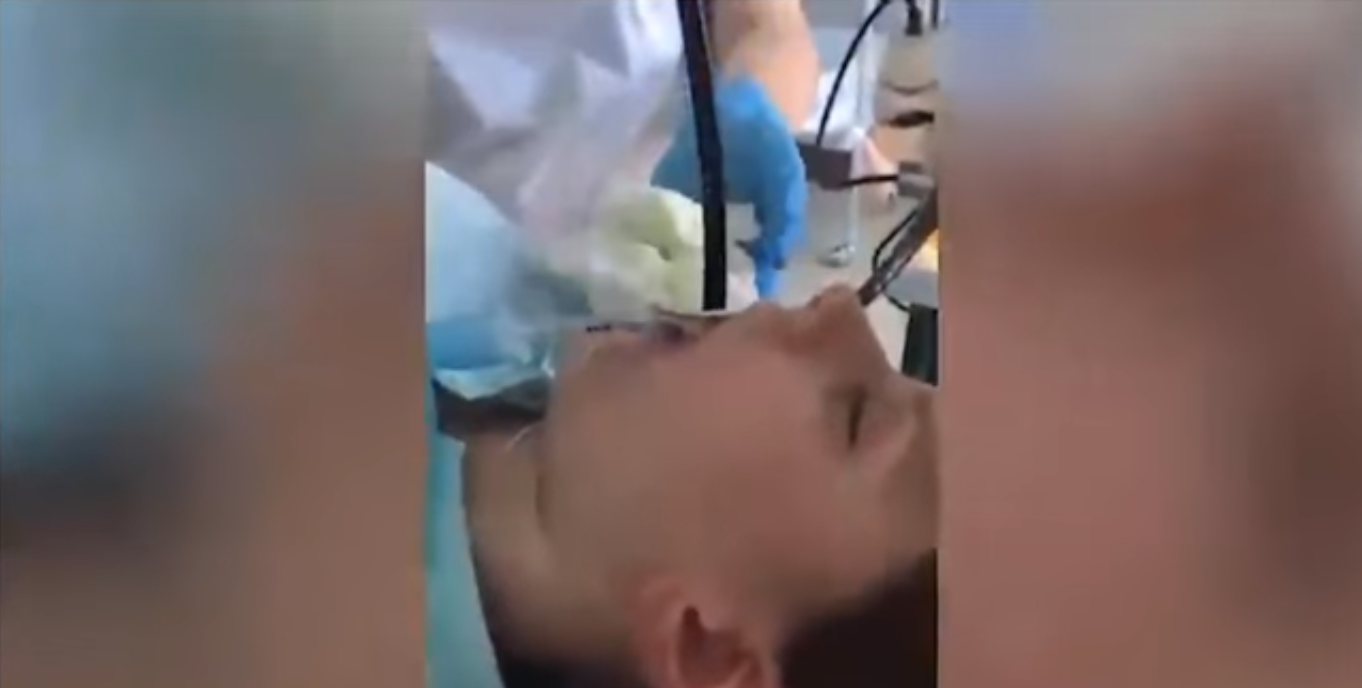 (Video) Médicos sacan serpiente de un metro de la garganta de una mujer en Rusia