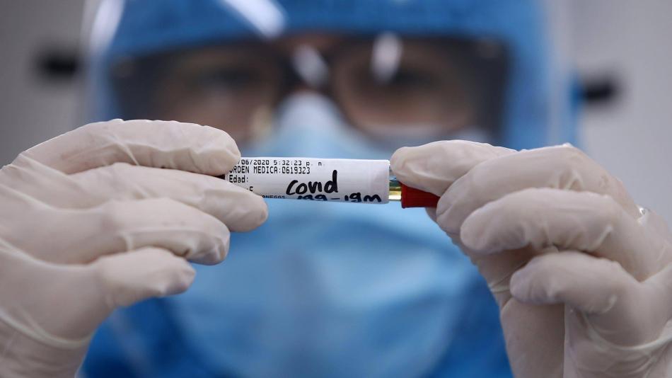 ¿Si vencí al Covid-19, desarrolle inmunidad o puedo volver a infectarme?