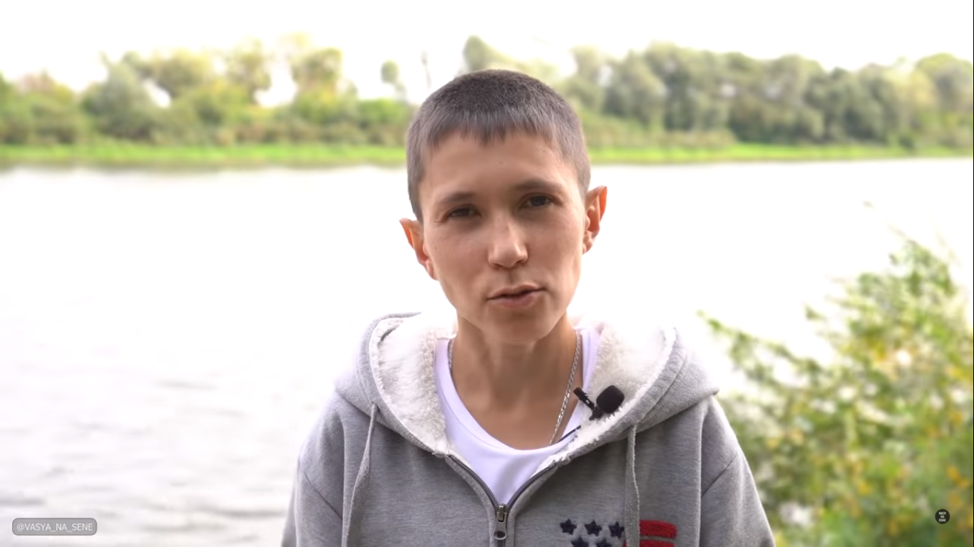 Historia de un hombre de 32 años con apariencia de adolecente