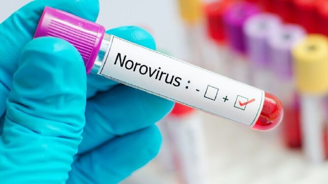 Norovirus el virus de China altamente contagioso, ¿Qué es y cómo se contagia?