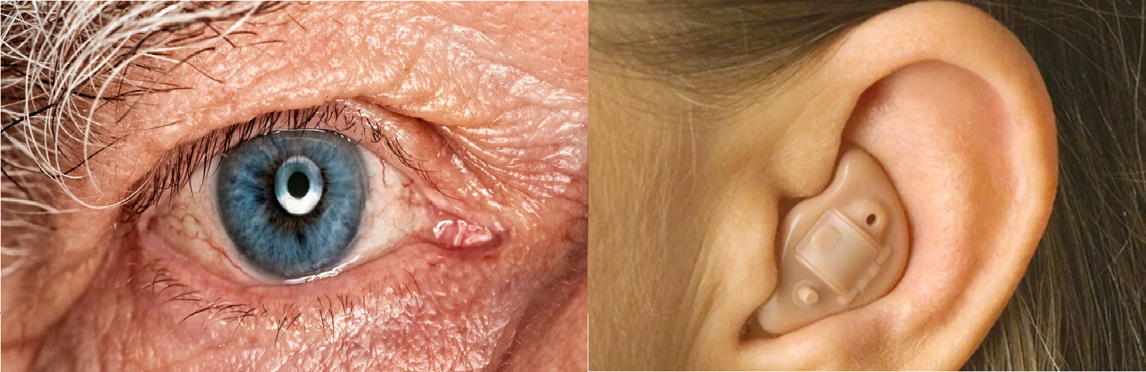 ¿Cómo solicitar apoyo de aparato auditivo o cirugía de cataratas en Toluca?