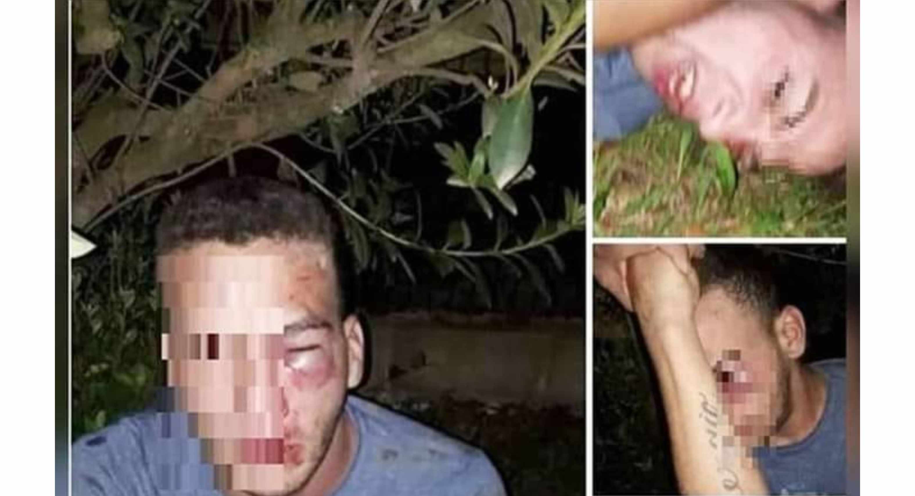 Hombre cita a menor en Argentina y recibe una golpiza por parte de la familia