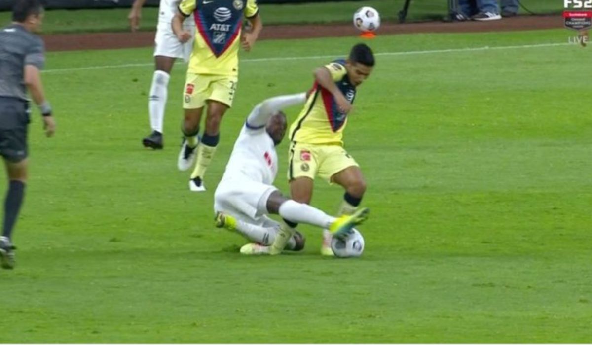 El jugador del américa Jesús López sufrió una aparatosa lesión