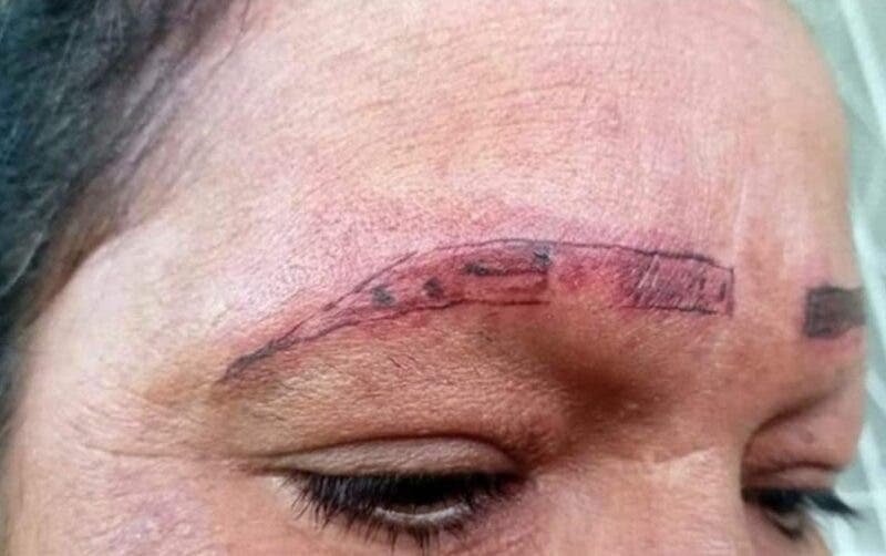 Mujer se queda sin cejas y en mal estado.