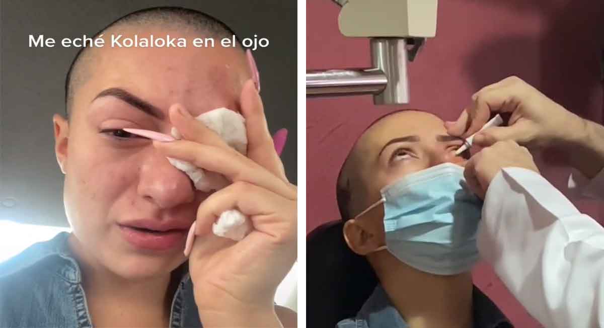 tiktoker influencer confunde gotas de los ojos con kola loka y termina mal